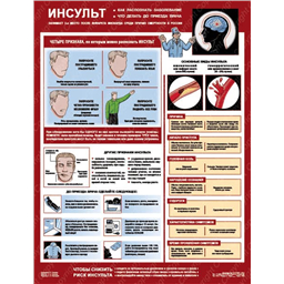Плакат Инсульт: как распознать, что делать (A3, лам.)